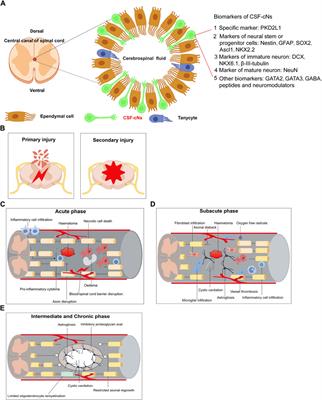 Roles of cerebrospinal fluid-contacting neurons as potential neural stem cells in the repair and regeneration of spinal cord injuries